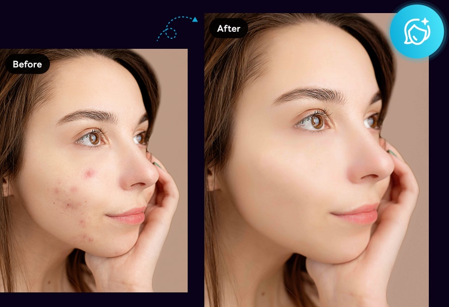 photo editor remove blemishes