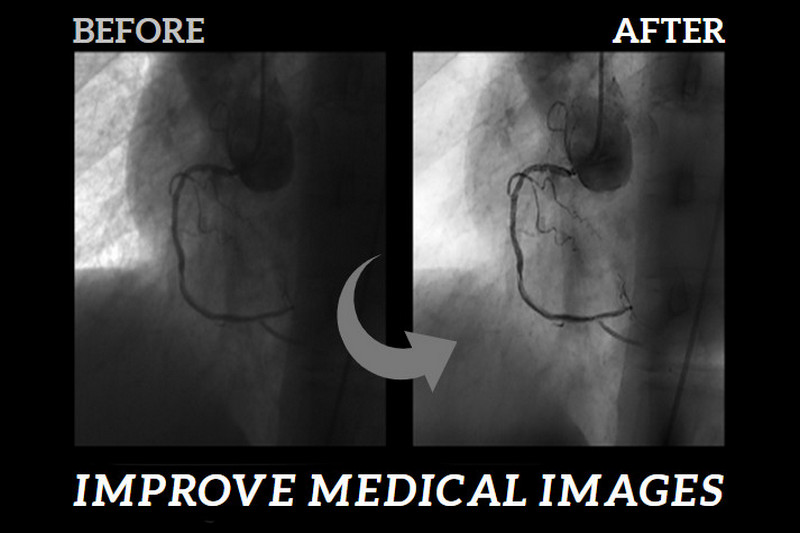 improve quality of medical images