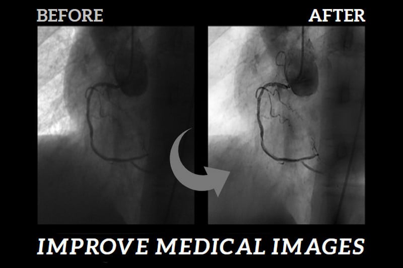 improve medical images quality