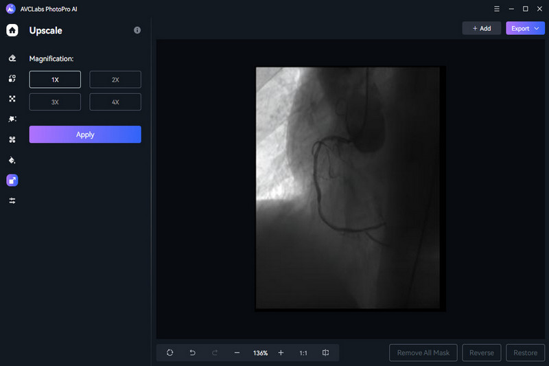 upscale medical image